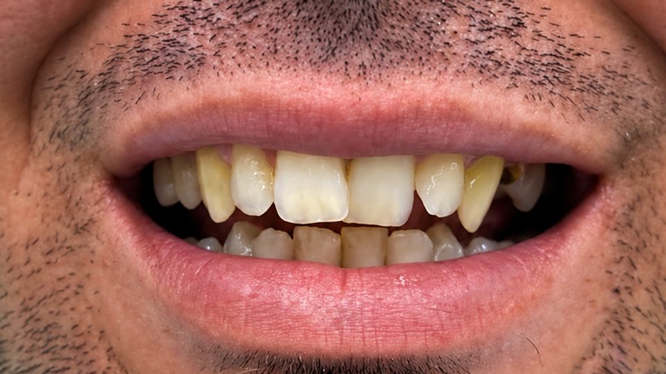 Before: Smile makeover
